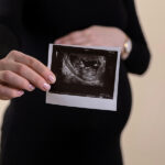 Can PCOS prevent pregnancy?