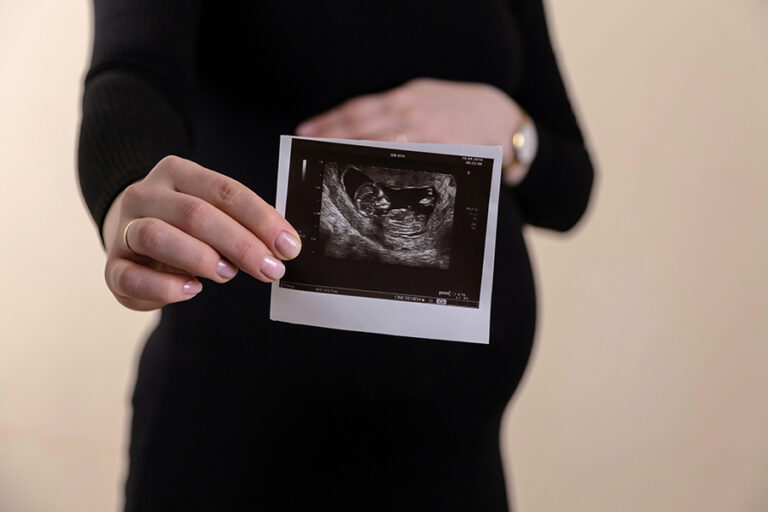 Can PCOS prevent pregnancy?