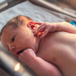 Newborn Acne and Skin Conditions