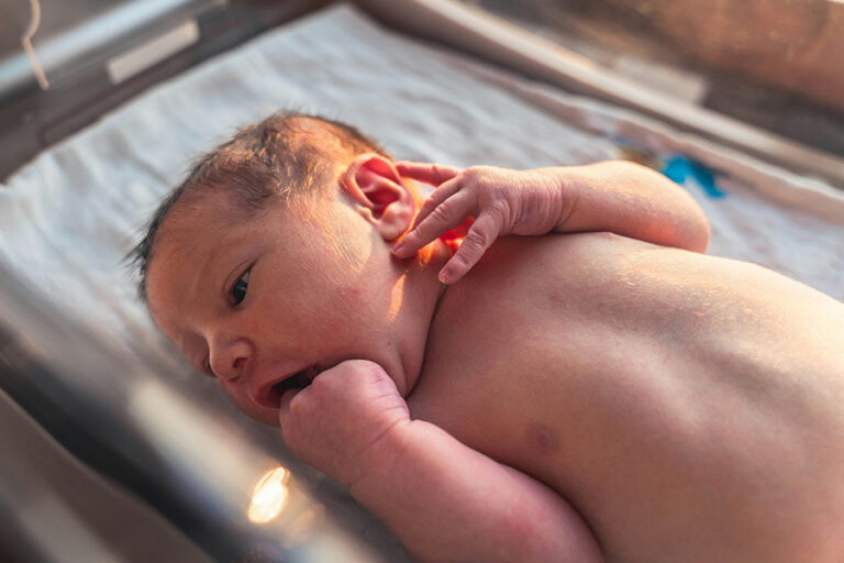 Newborn Acne and Skin Conditions